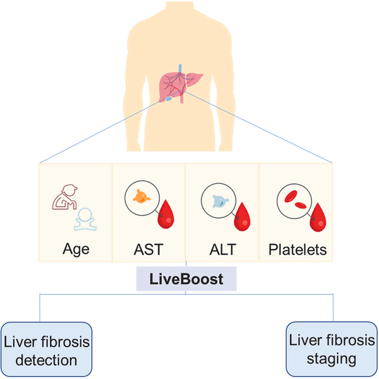 LiveBoost软件临床试验结果发表：评估肝纤维化准确率优于APRI和FIB-4