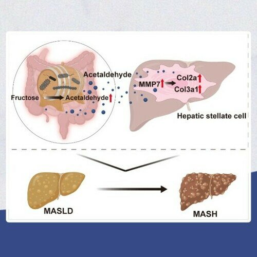 肝病防治新突破:揭秘高糖饮食伤肝机制,开发靶向“清醛”益生菌护肝