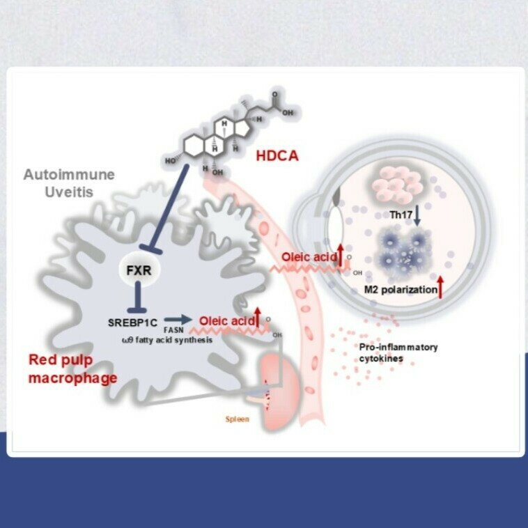 肠道胆汁酸调控“肠-脾-眼”免疫轴，创新自身免疫性葡萄膜炎防治