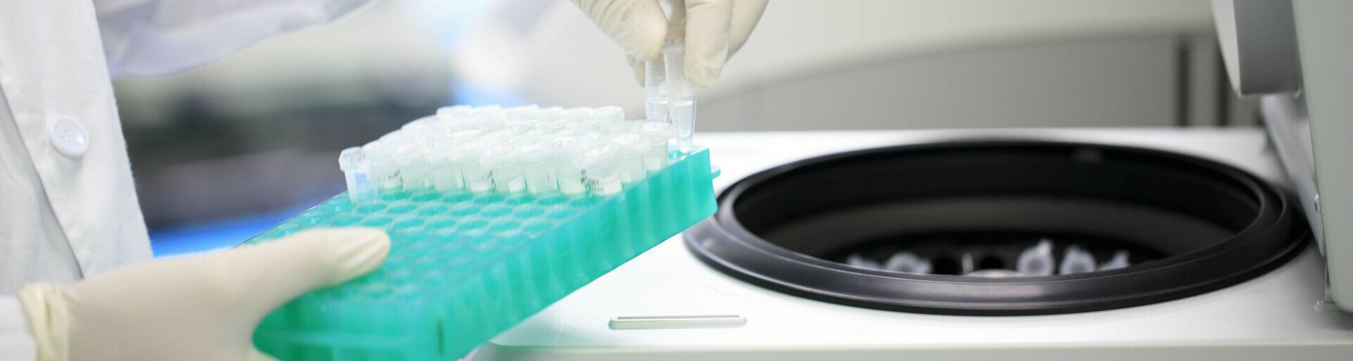 Alzheimer's Disease Screening Kit